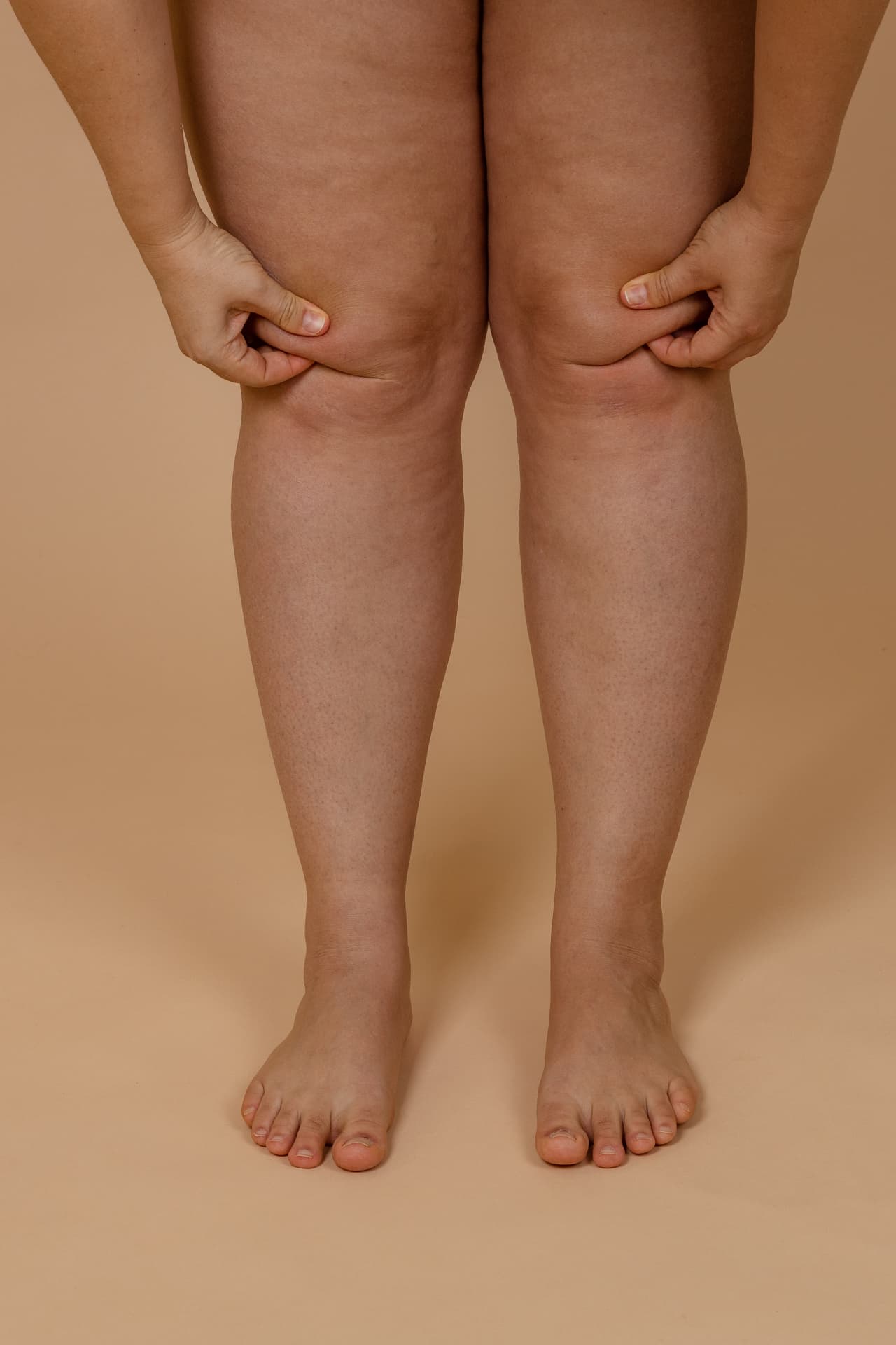 Hands gently pinching the tender tissue just above the knees